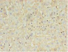 HBB / Hemoglobin Beta Antibody - Immunohistochemistry of paraffin-embedded human liver using antibody at 1:100 dilution.  This image was taken for the unconjugated form of this product. Other forms have not been tested.