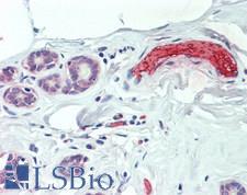 HBB / Hemoglobin Beta Antibody - Human Breast: Formalin-Fixed, Paraffin-Embedded (FFPE)