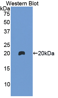 HBB / Hemoglobin Beta Antibody - Western blot of HBB / Hemoglobin Beta antibody.