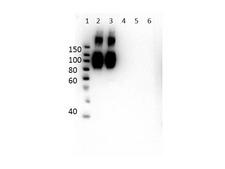 HBB / Hemoglobin Beta Antibody - Western Blot of Mouse Anti-Hemoglobin A (beta chain) Antibody. Lane 1: Molecular Weight Ladder. Lane 2: HbA peptide conjugated to BSA. Lane 3: HbA-2 peptide conjugated to BSA. Lane 4: HbC peptide conjugated to BSA. Lane 5: HbF peptide conjugated to BSA. Lane 6: HbS peptide conjugated to BSA. Load: 50ng per lane. Primary antibody: Anti-HbA antibody at 1µg/mL overnight at 4°C. Secondary antibody: Rabbit Anti-Mouse secondary antibody at 1:40,000 for 30 min at RT. Block: MB-073 for 30 min RT. Predicted/Observed: Reactivity seen in Lane 2 specific to HbA and cross reactivity to HbA-2 seen in Lane 3.