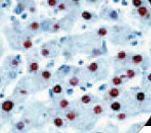 HBcAg / HBV Core Antigen Antibody - IHC of HBcAg on FFPE Infected Liver tissue. This image was taken for the unmodified form of this product. Other forms have not been tested.