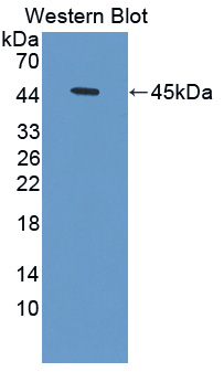 HBD / Hemoglobin Delta Antibody - Western blot of HBD / Hemoglobin Delta antibody.