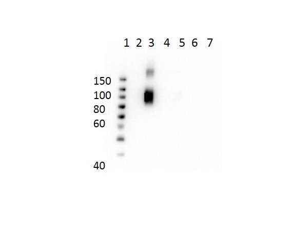 HBD / Hemoglobin Delta Antibody - Western Blot of Mouse Anti-Hemoglobin beta A-2 Antibody. Lane 1: Molecular Weight Ladder. Lane 2: HbA peptide conjugated to BSA. Lane 3: HbA-2 peptide conjugated to BSA. Lane 4: HbC peptide conjugated to BSA. Lane 5: HbF peptide conjugated to BSA. Lane 6: HbS peptide conjugated to BSA. Lane 7: BSA alone. Load: 50ng per lane. Primary antibody: Anti-HbA-2 antibody at 1µg/mL overnight at 4°C. Secondary antibody: Rabbit Anti-Mouse secondary antibody at 1:40,000 for 30 min at RT. Block: MB-073 for 30 min RT. Predicted/Observed: Reactivity seen in Lane 3 specific to HbA-2 only.