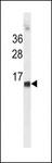 HBE1 / Hemoglobin Epsilon 1 Antibody - HBE1 Antibody western blot of K562 cell line lysates (35 ug/lane). The HBE1 antibody detected the HBE1 protein (arrow).
