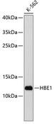 HBE1 / Hemoglobin Epsilon 1 Antibody - Western blot analysis of extracts of K-562 cells using HBE1 Polyclonal Antibody at dilution of 1:1000.
