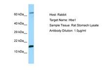 HBE1 / Hemoglobin Epsilon 1 Antibody -  This image was taken for the unconjugated form of this product. Other forms have not been tested.