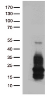 HBEGF / HB EGF Antibody - HEK293T cells were transfected with the pCMV6-ENTRY control. (Left lane) or pCMV6-ENTRY HBEGF. (Right lane) cDNA for 48 hrs and lysed