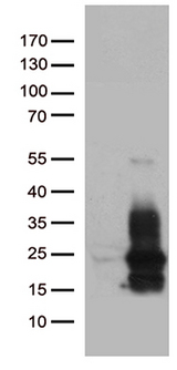 HBEGF / HB EGF Antibody - HEK293T cells were transfected with the pCMV6-ENTRY control. (Left lane) or pCMV6-ENTRY HBEGF. (Right lane) cDNA for 48 hrs and lysed. Equivalent amounts of cell lysates. (5 ug per lane) were separated by SDS-PAGE and immunoblotted with anti-HBEGF. (1:2000)
