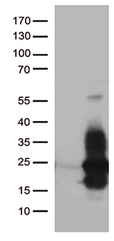 HBEGF / HB EGF Antibody - HEK293T cells were transfected with the pCMV6-ENTRY control. (Left lane) or pCMV6-ENTRY HBEGF. (Right lane) cDNA for 48 hrs and lysed. Equivalent amounts of cell lysates. (5 ug per lane) were separated by SDS-PAGE and immunoblotted with anti-HBEGF. (1:2000)