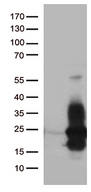 HBEGF / HB EGF Antibody - HEK293T cells were transfected with the pCMV6-ENTRY control. (Left lane) or pCMV6-ENTRY HBEGF. (Right lane) cDNA for 48 hrs and lysed