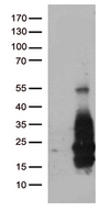 HBEGF / HB EGF Antibody - HEK293T cells were transfected with the pCMV6-ENTRY control. (Left lane) or pCMV6-ENTRY HBEGF. (Right lane) cDNA for 48 hrs and lysed. Equivalent amounts of cell lysates. (5 ug per lane) were separated by SDS-PAGE and immunoblotted with anti-HBEGF. (1:2000)