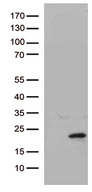 HBEGF / HB EGF Antibody - HEK293T cells were transfected with the pCMV6-ENTRY control. (Left lane) or pCMV6-ENTRY HBEGF. (Right lane) cDNA for 48 hrs and lysed. Equivalent amounts of cell lysates. (5 ug per lane) were separated by SDS-PAGE and immunoblotted with anti-HBEGF. (1:2000)