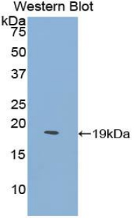 HBEGF / HB EGF Antibody - Western blot of recombinant HBEGF.