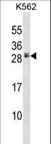 HBEGF / HB EGF Antibody - HBEGF Antibody western blot of K562 cell line lysates (35 ug/lane). The HBEGF antibody detected the HBEGF protein (arrow).