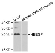 HBEGF / HB EGF Antibody - Western blot analysis of extracts of various cell lines, using HBEGF antibody at 1:1000 dilution. The secondary antibody used was an HRP Goat Anti-Rabbit IgG (H+L) at 1:10000 dilution. Lysates were loaded 25ug per lane and 3% nonfat dry milk in TBST was used for blocking.