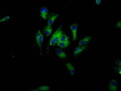HBEGF / HB EGF Antibody - Immunofluorescence staining of Hela cells at a dilution of 1:33, counter-stained with DAPI. The cells were fixed in 4% formaldehyde, permeabilized using 0.2% Triton X-100 and blocked in 10% normal Goat Serum. The cells were then incubated with the antibody overnight at 4 °C.The secondary antibody was Alexa Fluor 488-congugated AffiniPure Goat Anti-Rabbit IgG (H+L) .