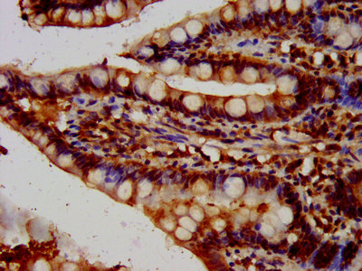 HBEGF / HB EGF Antibody - IHC image of HBEGF Antibody diluted at 1:100 and staining in paraffin-embedded human small intestine tissue performed on a Leica BondTM system. After dewaxing and hydration, antigen retrieval was mediated by high pressure in a citrate buffer (pH 6.0). Section was blocked with 10% normal goat serum 30min at RT. Then primary antibody (1% BSA) was incubated at 4°C overnight. The primary is detected by a biotinylated secondary antibody and visualized using an HRP conjugated SP system.