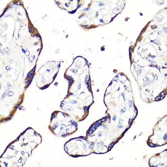 HBEGF / HB EGF Antibody - Immunohistochemistry of paraffin-embedded Human placenta using HBEGF Polyclonal Antibody at dilution of 1:100 (40x lens).