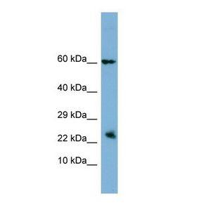 HBEGF / HB EGF Antibody - Western blot of Human PANC1 cell lysate. Anti-HBEGF antibody dilution 1.0 ug/ml.  This image was taken for the unconjugated form of this product. Other forms have not been tested.