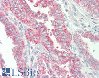 HBEGF / HB EGF Antibody - Human Uterus: Formalin-Fixed, Paraffin-Embedded (FFPE).  This image was taken for the unconjugated form of this product. Other forms have not been tested.