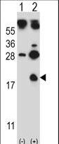HBG1 / Fetal Hemoglobin Antibody - Western blot of HBG1 (arrow) using rabbit polyclonal HBG1 Antibody. 293 cell lysates (2 ug/lane) either nontransfected (Lane 1) or transiently transfected (Lane 2) with the HBG1 gene.
