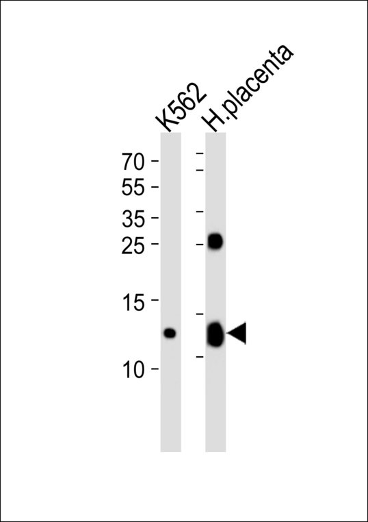 HBG2 / Hemoglobin Gamma 2 Antibody - Western blot of lysates from K562 cell line and human placenta tissue lysate (from left to right) with HBG2 Antibody. Antibody was diluted at 1:1000 at each lane. A goat anti-rabbit IgG H&L (HRP) at 1:5000 dilution was used as the secondary antibody. Lysates at 35 ug per lane.