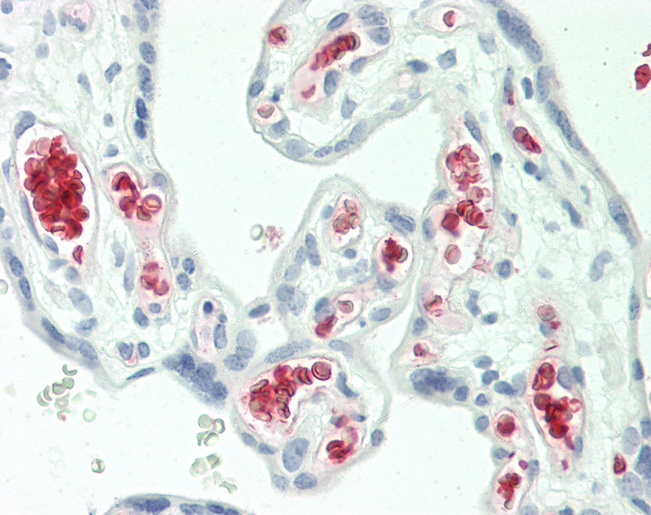 HBG2 / Hemoglobin Gamma 2 Antibody - Human Placenta: Formalin-Fixed, Paraffin-Embedded (FFPE).  This image was taken for the unconjugated form of this product. Other forms have not been tested.