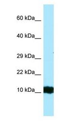 HBG2 / Hemoglobin Gamma 2 Antibody - HBG2 antibody Western Blot of Fetal Kidney.  This image was taken for the unconjugated form of this product. Other forms have not been tested.