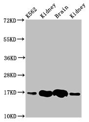 HBG2 / Hemoglobin Gamma 2 Antibody - Western Blot Positive WB detected in: K562 whole cell lysate, Rat kideny tissue, Rat brain tissue, Mouse kidney tissue All lanes: HBG2 antibody at 4.6µg/ml Secondary Goat polyclonal to rabbit IgG at 1/50000 dilution Predicted band size: 17 kDa Observed band size: 17 kDa