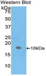 HBM Antibody - Western blot of recombinant HBM.  This image was taken for the unconjugated form of this product. Other forms have not been tested.