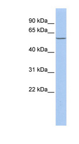 HBP1 Antibody - HBP1 antibody Western blot of Jurkat lysate. This image was taken for the unconjugated form of this product. Other forms have not been tested.
