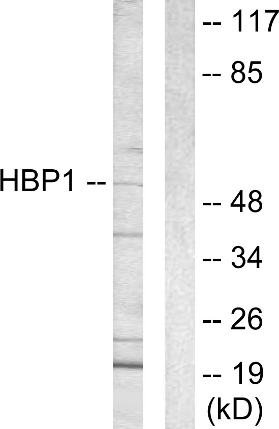 HBP1 Antibody - Western blot analysis of lysates from COS7 cells, using HBP1 Antibody. The lane on the right is blocked with the synthesized peptide.