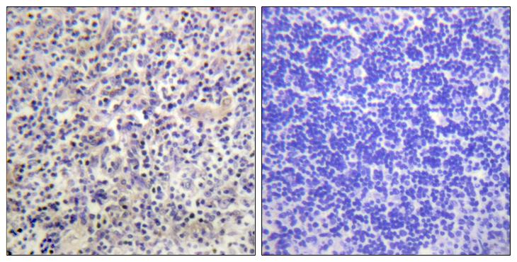 HBP1 Antibody - Peptide - + Immunohistochemistry analysis of paraffin-embedded human thyroid gland tissue using HBP1 antibody.