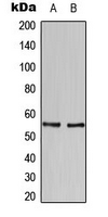 HBP1 Antibody - Western blot analysis of HBP1 expression in SKBR3 (A); U937 (B) whole cell lysates.
