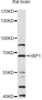 HBP1 Antibody - Western blot analysis of extracts of rat brain, using HBP1 antibody at 1:1000 dilution. The secondary antibody used was an HRP Goat Anti-Rabbit IgG (H+L) at 1:10000 dilution. Lysates were loaded 25ug per lane and 3% nonfat dry milk in TBST was used for blocking. An ECL Kit was used for detection and the exposure time was 3min.