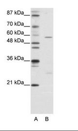 HBP1 Antibody - A: Marker, B: Jurkat Cell Lysate.  This image was taken for the unconjugated form of this product. Other forms have not been tested.