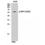 HBP1 Antibody - Western blot of Phospho-HBP1 (S402) antibody