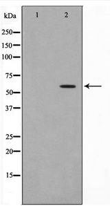HBP1 Antibody - Western blot of A549 cell lysate using Phospho-HBP1(Ser402) Antibody
