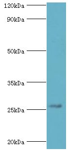 HBP17 / FGFBP1 Antibody - Western blot. All lanes: Fibroblast growth factor-binding protein 1 antibody at 5 ug/ml+mouse skeletal muscle tissue. Secondary antibody: Goat polyclonal to rabbit at 1:10000 dilution. Predicted band size: 26 kDa. Observed band size: 26 kDa Immunohistochemistry.
