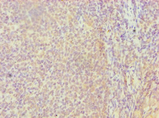 HBP17 / FGFBP1 Antibody - Immunohistochemistry of paraffin-embedded human tonsil tissue using FGFBP1 Antibody at dilution of 1:100