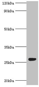 HBP17 / FGFBP1 Antibody - Western blot All lanes: Fibroblast growth factor-binding protein 1 antibody at 5µg/ml + Mouse skeletal muscle tissue Secondary Goat polyclonal to rabbit IgG at 1/10000 dilution Predicted band size: 26 kDa Observed band size: 26 kDa