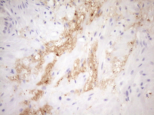 HBP17 / FGFBP1 Antibody - Immunohistochemical staining of paraffin-embedded Human prostate tissue within the normal limits using anti-FGFBP1 mouse monoclonal antibody. (Heat-induced epitope retrieval by Tris-EDTA, pH8.0)(1:150)
