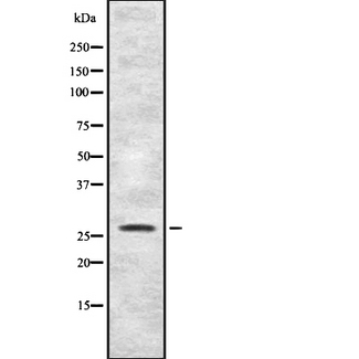 HBP17 / FGFBP1 Antibody - Western blot analysis of FGFP1 expression in HEK293 cells. The lane on the left is treated with the antigen-specific peptide.