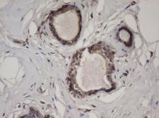 HBS1L Antibody - IHC of paraffin-embedded Human breast tissue using anti-HBS1L mouse monoclonal antibody. (Heat-induced epitope retrieval by 10mM citric buffer, pH6.0, 100C for 10min).