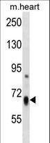 HBS1L Antibody - HBS1L Antibody western blot of mouse heart tissue lysates (35 ug/lane). The HBS1L antibody detected the HBS1L protein (arrow).