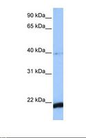 HBS1L Antibody - MCF7 cell lysate. Antibody concentration: 1.0 ug/ml. Gel concentration: 12%.  This image was taken for the unconjugated form of this product. Other forms have not been tested.