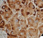 HBV / HBsAg Antibody - IHC of HBsAg on FFPE infected Liver tissue.