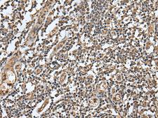 HBXIP Antibody - Immunohistochemistry of paraffin-embedded Human tonsil tissue  using LAMTOR5 Polyclonal Antibody at dilution of 1:55(×200)