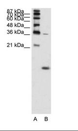 HBZ Antibody - A: Marker, B: K562 Cell Lysate.  This image was taken for the unconjugated form of this product. Other forms have not been tested.