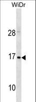 HBZ Antibody - HBZ Antibody western blot of WiDr cell line lysates (35 ug/lane). The HBZ antibody detected the HBZ protein (arrow).
